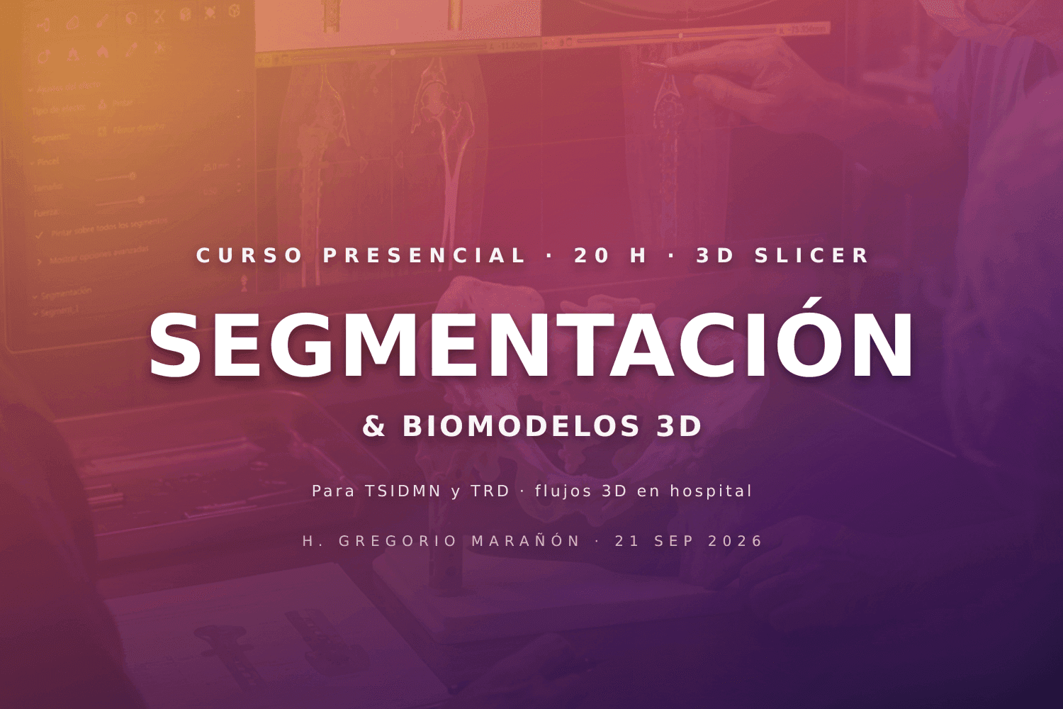 Tecnologías 3D para Técnicos: Segmentación y Biomodelos Virtuales